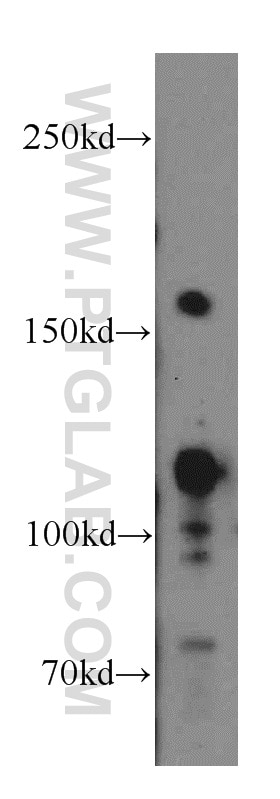 SRC3/NCOA3 Polyclonal antibody