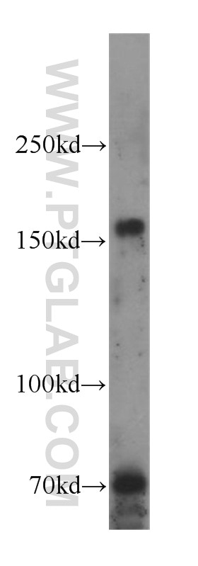 Western Blot (WB) analysis of Raji cells using SRC-3/AIB1 Polyclonal antibody (22707-1-AP)