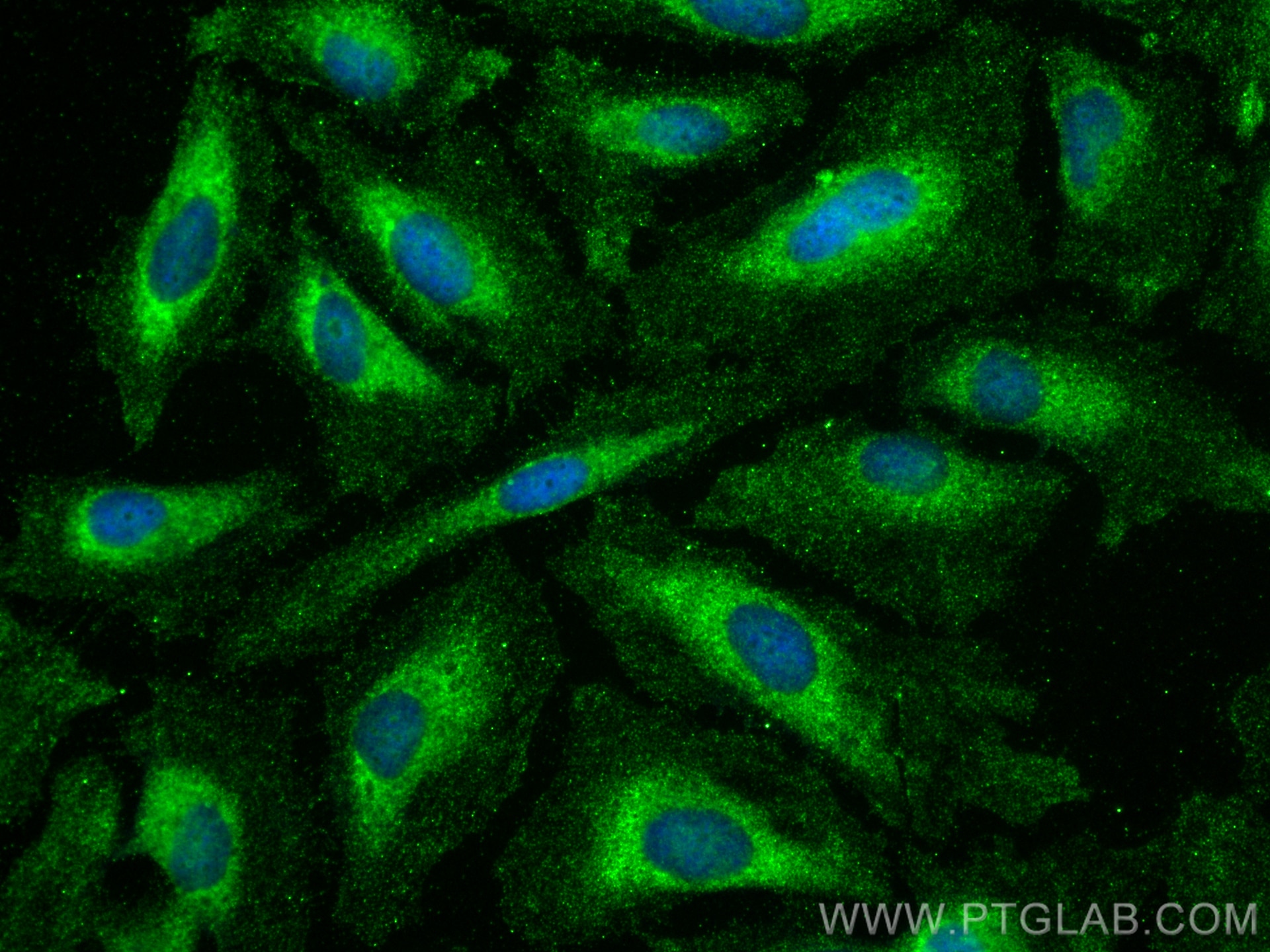 Immunofluorescence (IF) / fluorescent staining of HeLa cells using NCOA3 Polyclonal antibody (29587-1-AP)