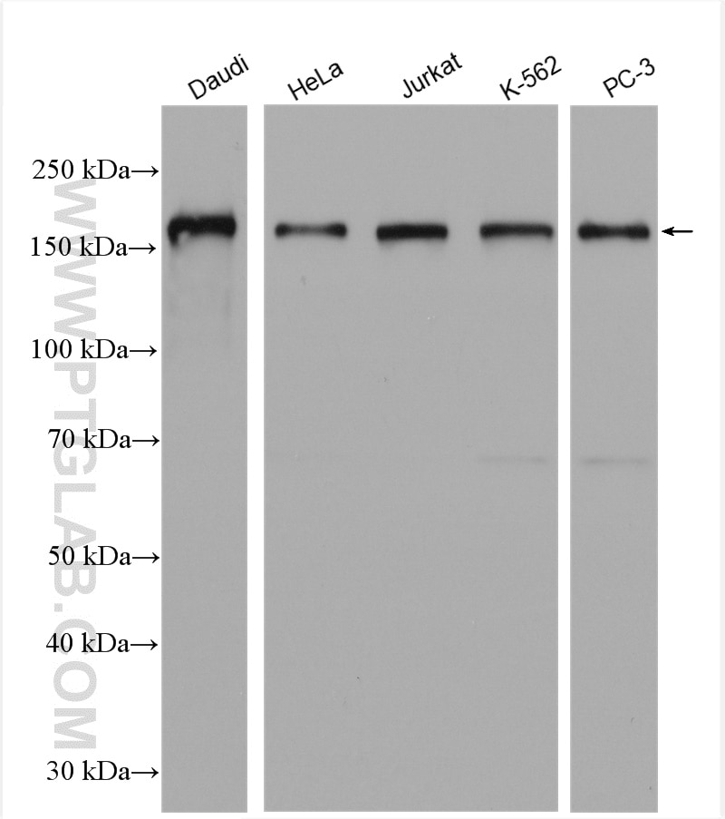 Western Blot (WB) analysis of various lysates using NCOA3 Polyclonal antibody (29587-1-AP)