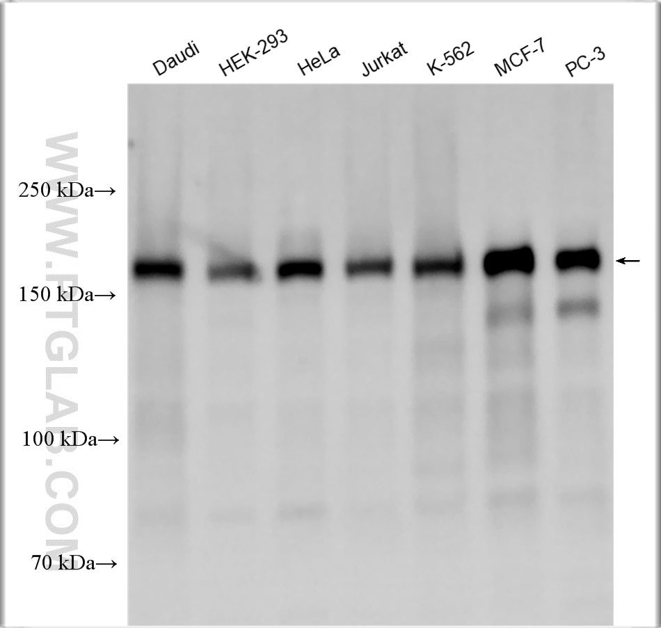 Western Blot (WB) analysis of various lysates using NCOA3 Polyclonal antibody (29587-1-AP)