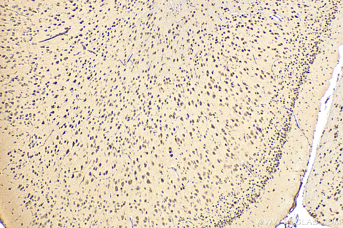 Immunohistochemistry (IHC) staining of mouse brain tissue using NCOA4 Polyclonal antibody (10968-1-AP)
