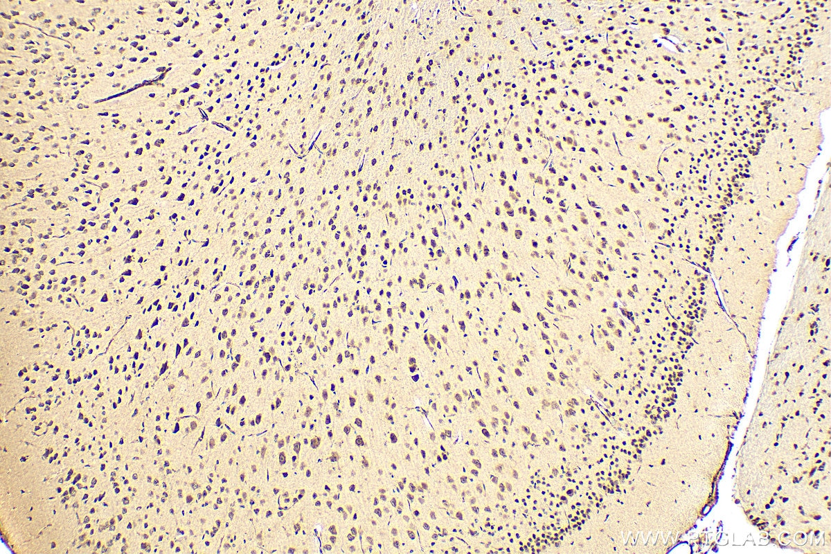 Immunohistochemistry (IHC) staining of mouse brain tissue using NCOA4 Polyclonal antibody (10968-1-AP)