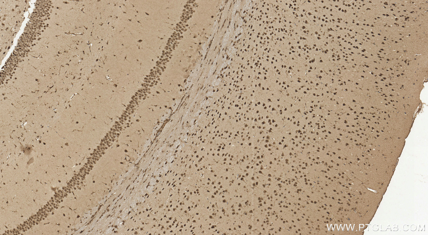 Immunohistochemistry (IHC) staining of mouse brain tissue using NCOA4 Polyclonal antibody (10968-1-AP)