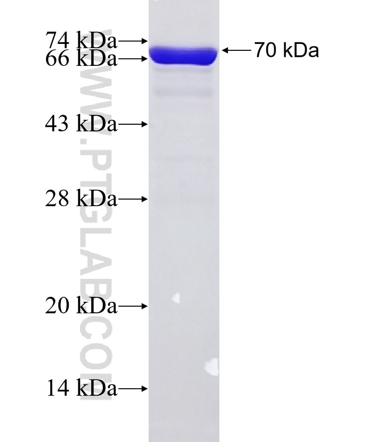 NCOA4 fusion protein Ag1408 SDS-PAGE