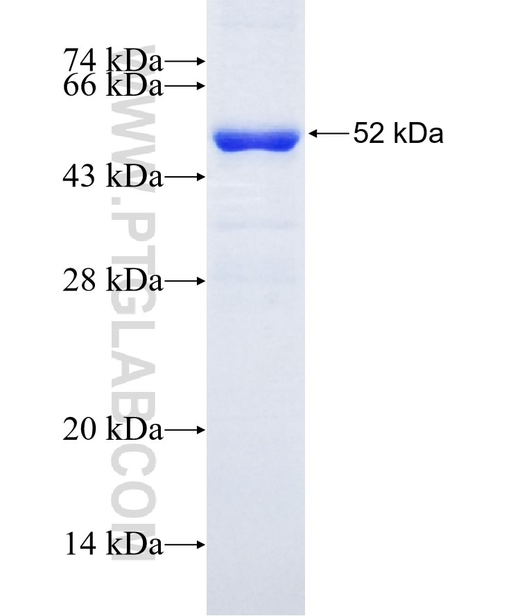 NCOA4 fusion protein Ag15277 SDS-PAGE