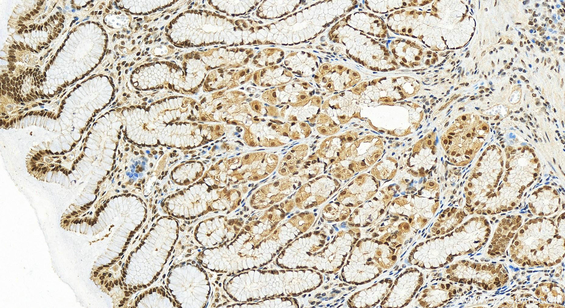 Immunohistochemistry (IHC) staining of human stomach tissue using NCOA5 Polyclonal antibody (20175-1-AP)