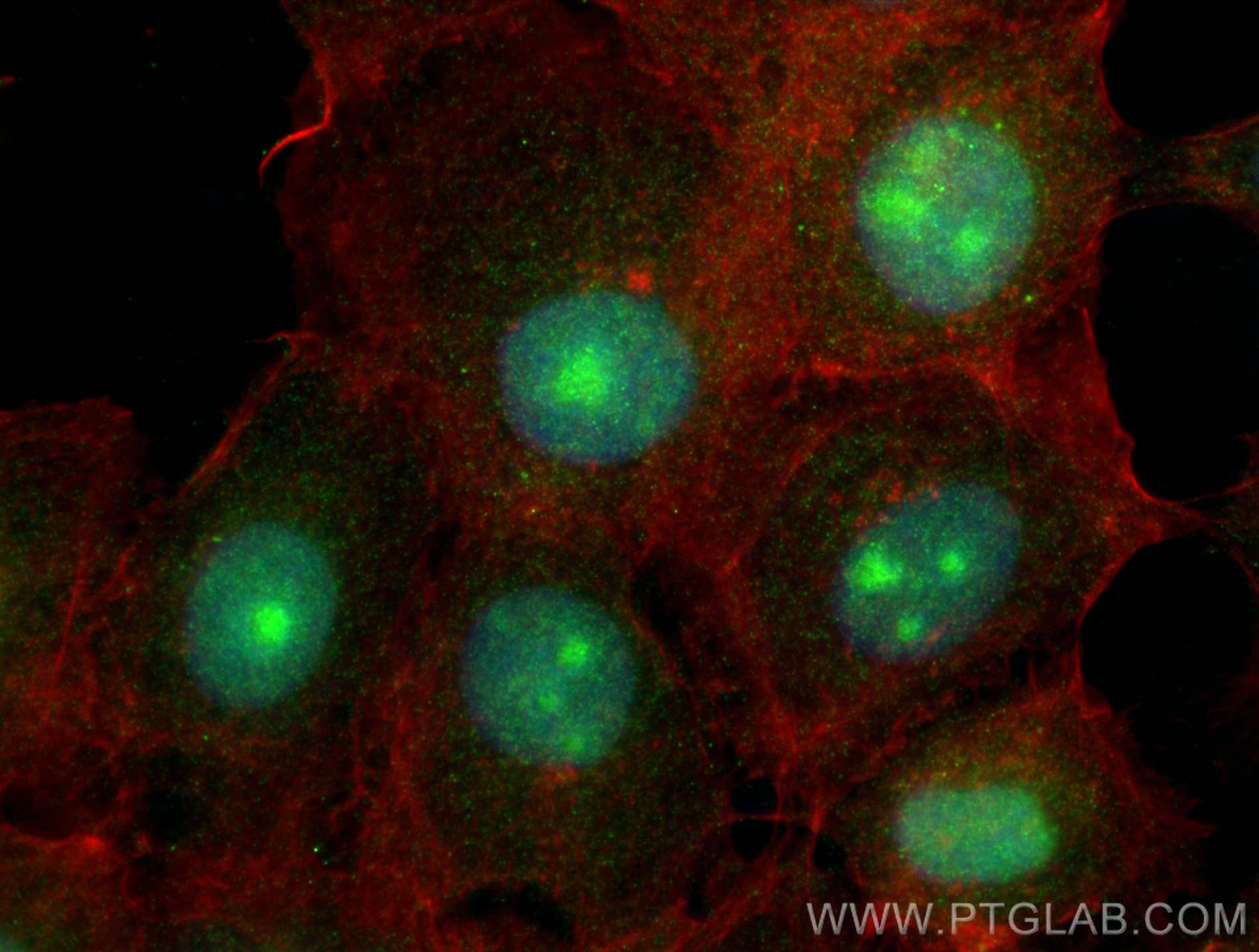 Immunofluorescence (IF) / fluorescent staining of A431 cells using NCOA5 Polyclonal antibody (20175-1-AP)