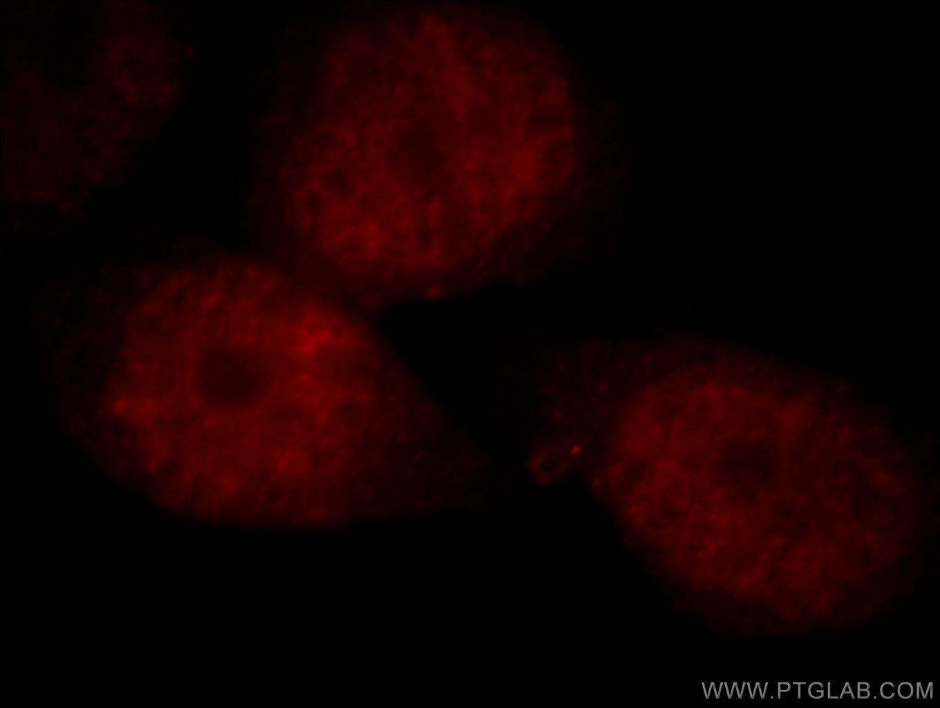 Immunofluorescence (IF) / fluorescent staining of HeLa cells using NCOA5 Polyclonal antibody (20175-1-AP)