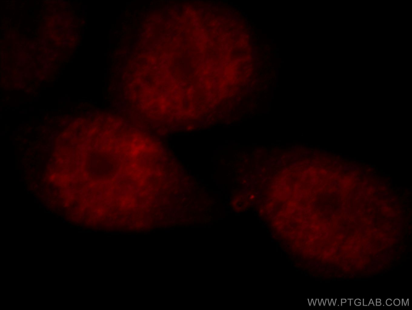 IF Staining of HeLa using 20175-1-AP