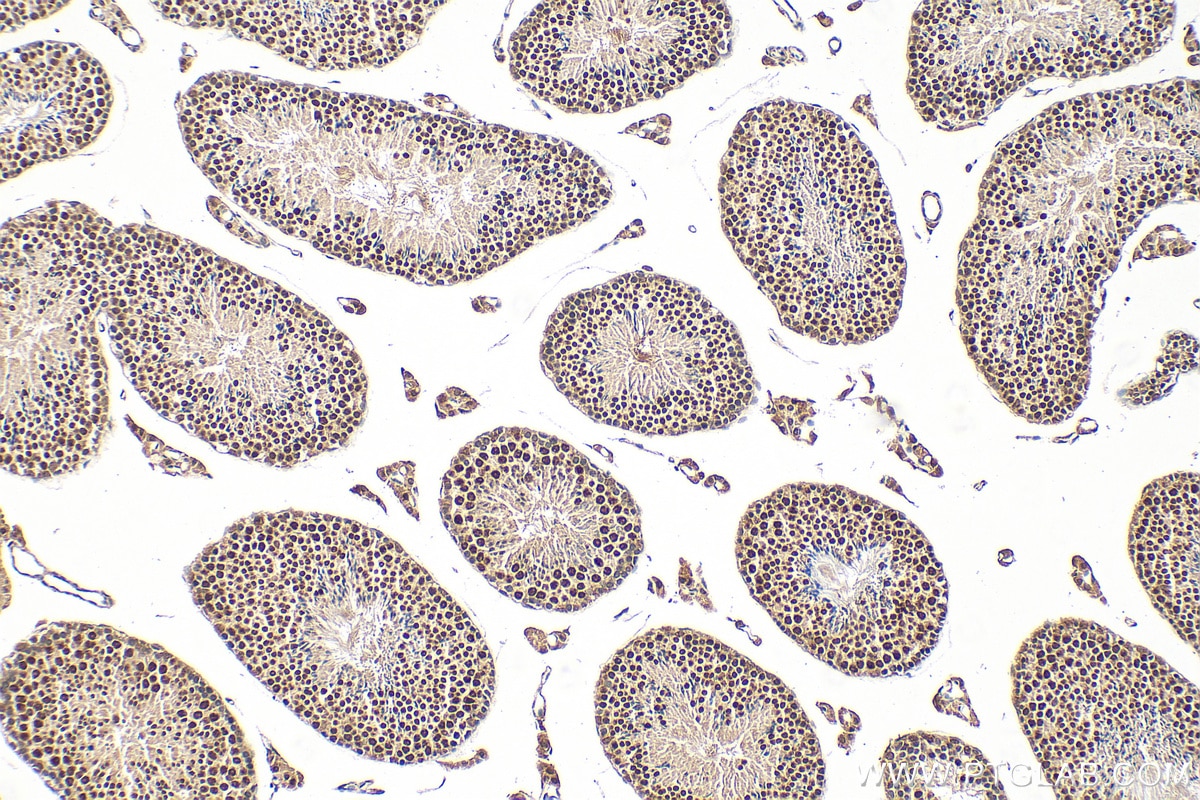 Immunohistochemical analysis of paraffin-embedded mouse testis tissue slide using 20175-1-AP (NCOA5 antibody) at dilution of 1:400 (under 10x lens). Heat mediated antigen retrieval with Tris-EDTA buffer (pH 9.0). Immunohistochemistry (IHC) staining of mouse testis tissue using NCOA5 Polyclonal antibody (20175-1-AP)