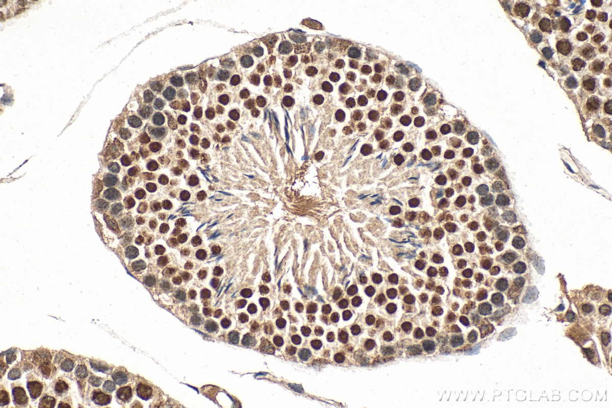 Immunohistochemistry (IHC) staining of mouse testis tissue using NCOA5 Polyclonal antibody (20175-1-AP)