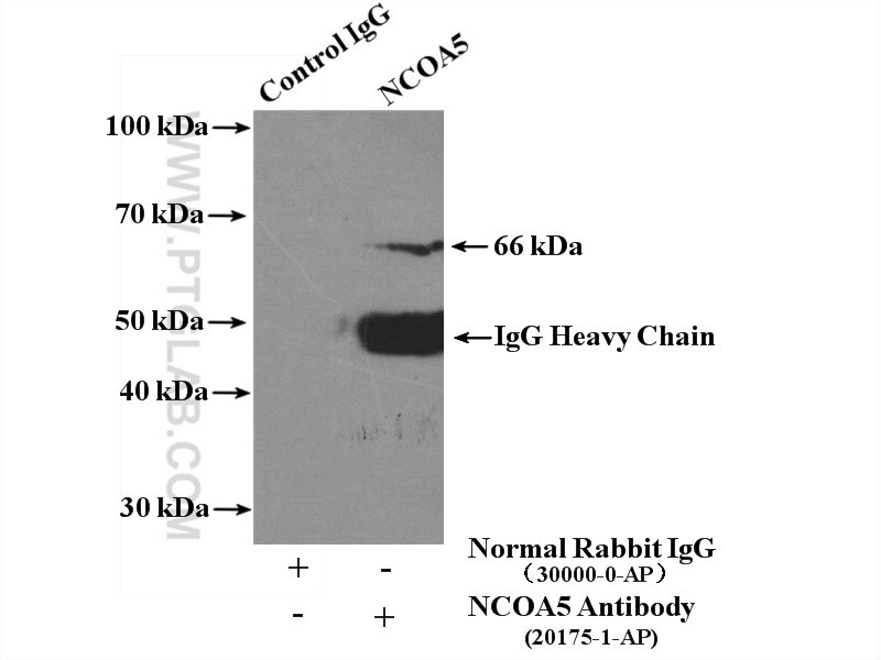 Immunoprecipitation (IP) experiment of HEK-293 cells using NCOA5 Polyclonal antibody (20175-1-AP)