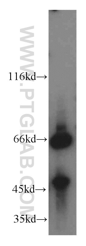 Western Blot (WB) analysis of HeLa cells using NCOA5 Polyclonal antibody (20175-1-AP)