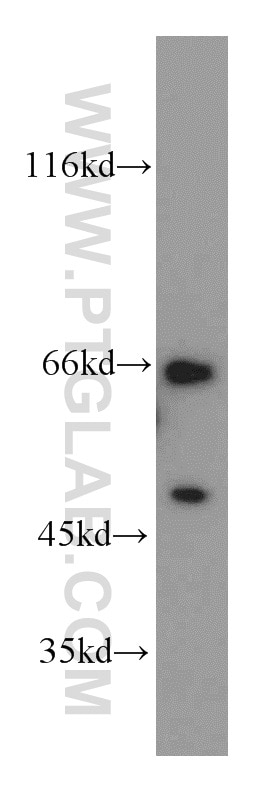 Western Blot (WB) analysis of HEK-293 cells using NCOA5 Polyclonal antibody (20175-1-AP)