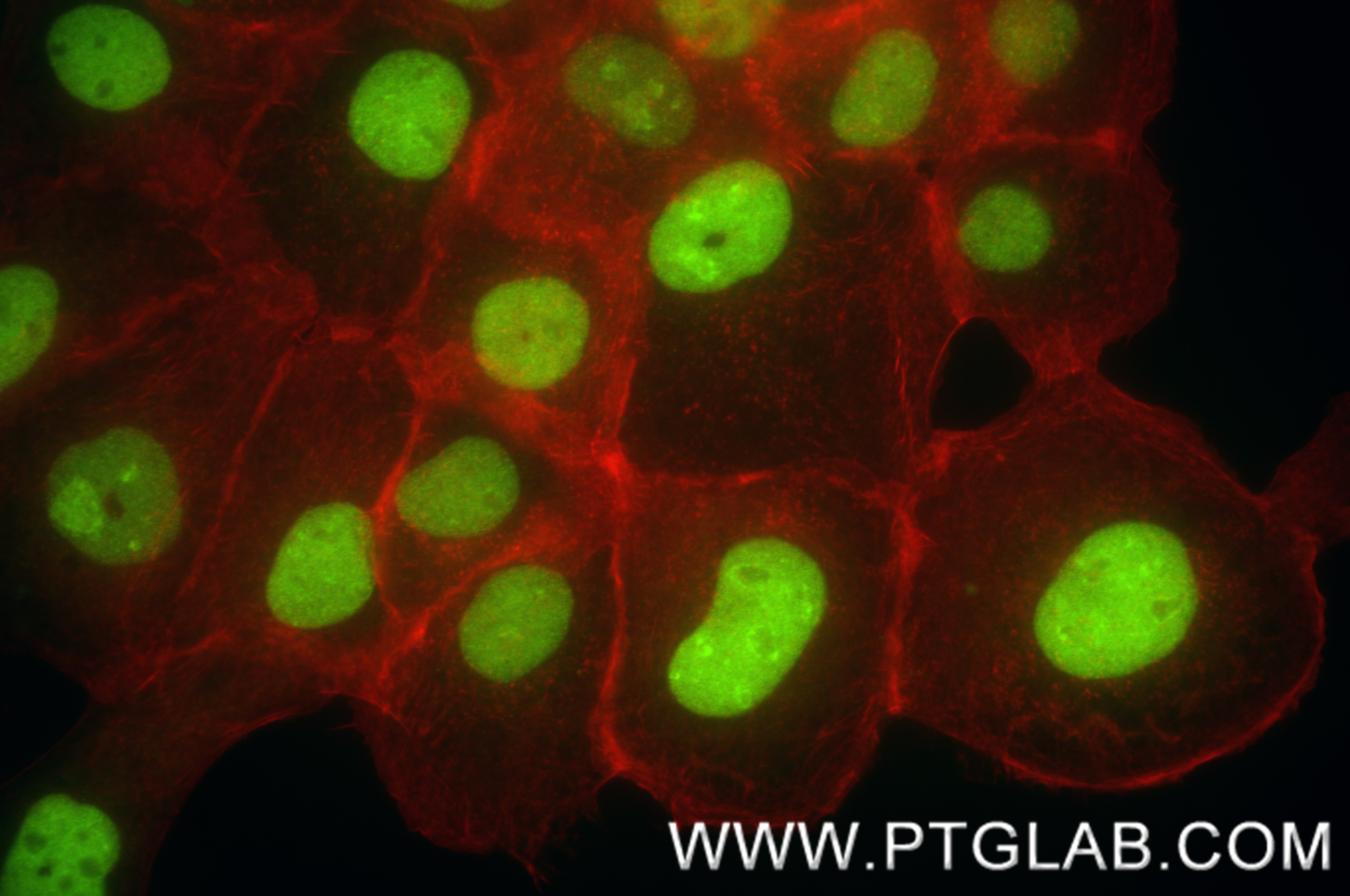 Immunofluorescence (IF) / fluorescent staining of A431 cells using NCOA5 Recombinant antibody (85004-1-RR)