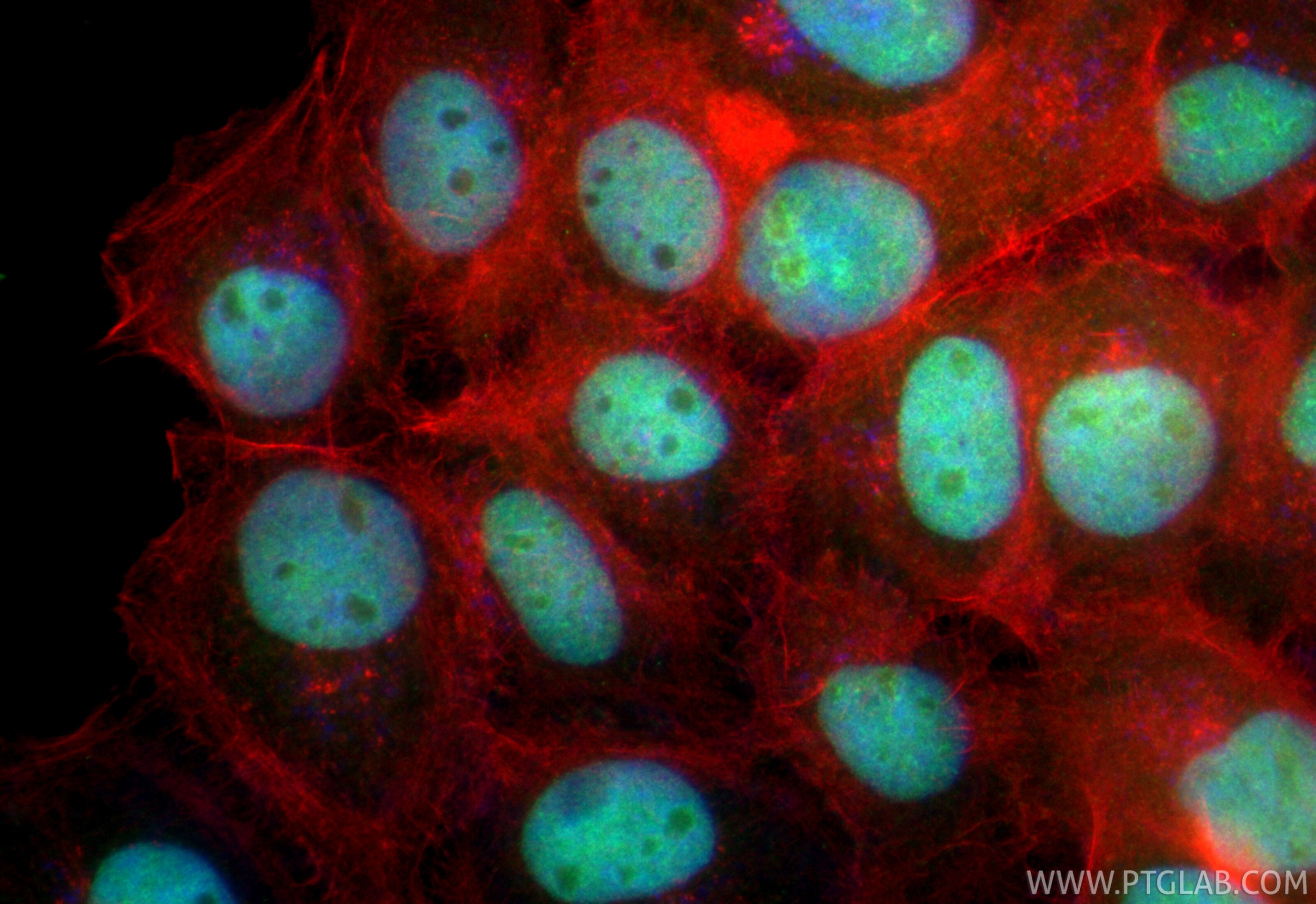 Immunofluorescent analysis of (4% PFA) fixed A431 cells using CoraLite® Plus 488 NCOA5 antibody (CL488-85004, Clone: 241969G3 ) at dilution of 1:200, CL594-Phalloidin (red). Immunofluorescence (IF) / fluorescent staining of A431 cells using CoraLite® Plus 488-conjugated NCOA5 Recombinant mo (CL488-85004)