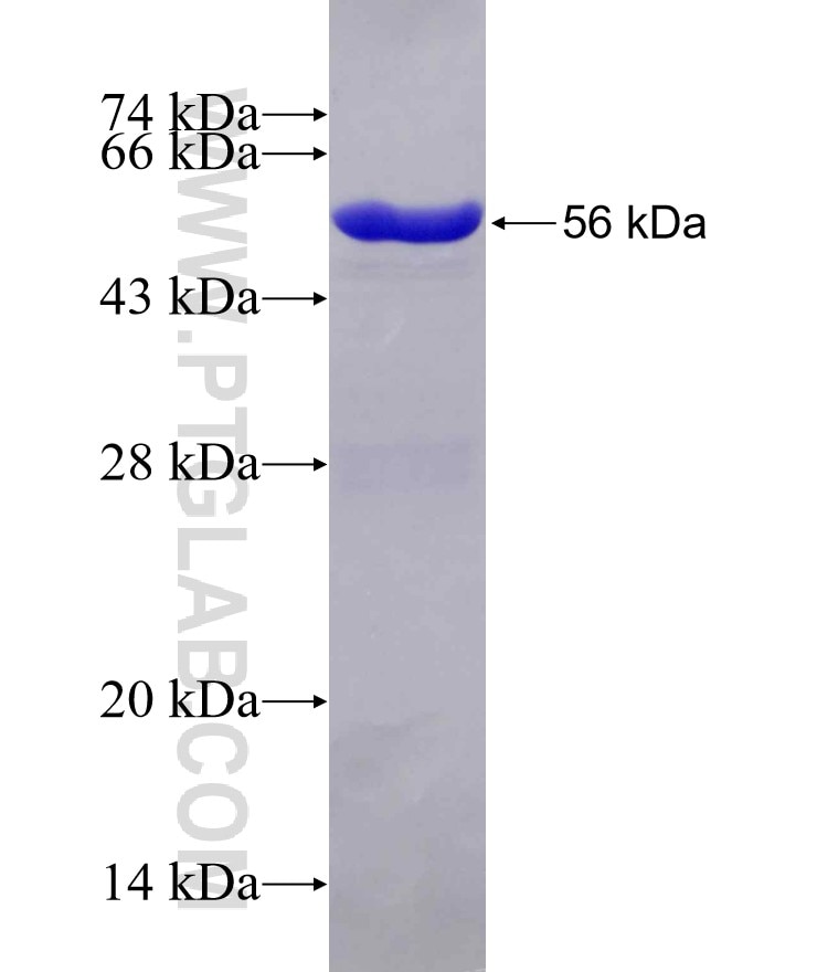 NCOA5 fusion protein Ag14014 SDS-PAGE