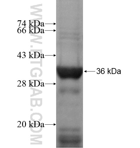 NCOA5 fusion protein Ag14418 SDS-PAGE