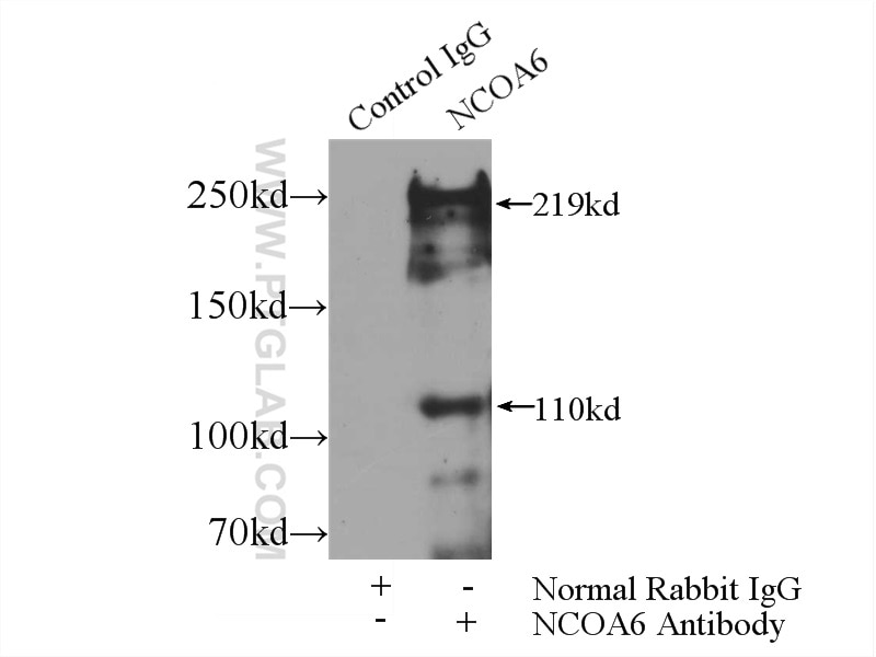 Immunoprecipitation (IP) experiment of HEK-293 cells using NCOA6 Polyclonal antibody (25241-1-AP)
