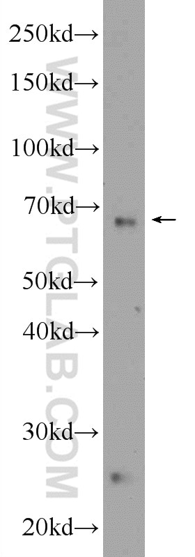 Western Blot (WB) analysis of mouse liver tissue using NCOA6 Polyclonal antibody (25241-1-AP)
