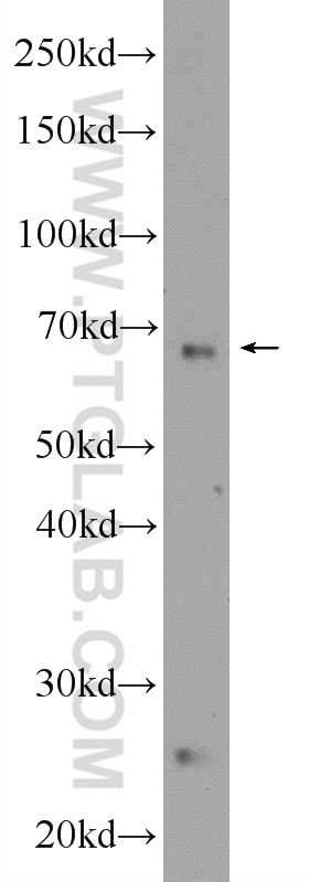 WB analysis of mouse liver using 25241-1-AP