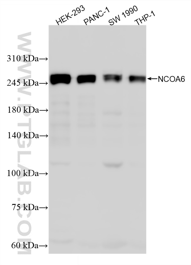 WB analysis using 87454-1-RR (same clone as 87454-1-PBS) Western Blot (WB) analysis of various lysates using NCOA6 Recombinant monoclonal antibody (87454-1-RR)