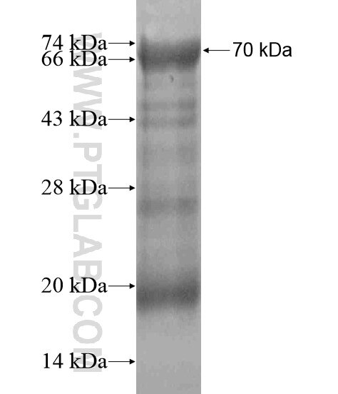 NCOA6 fusion protein Ag18737 SDS-PAGE
