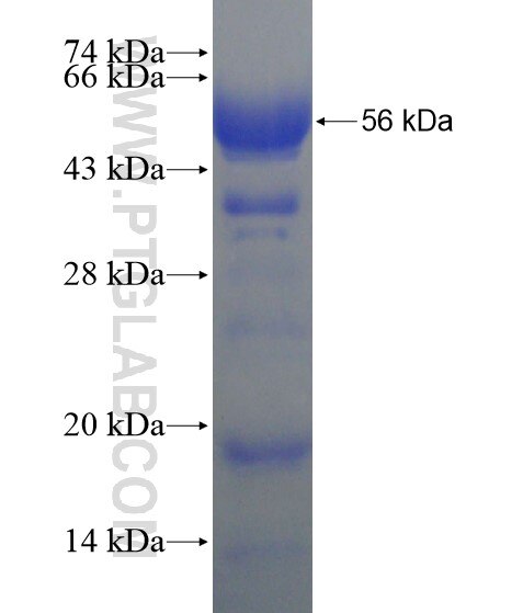 NCOA6 fusion protein Ag18880 SDS-PAGE