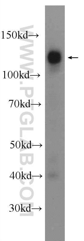 Western Blot (WB) analysis of HEK-293 cells using NCOA7 Polyclonal antibody (23092-1-AP)