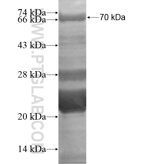 NCOA7 fusion protein Ag19315 SDS-PAGE