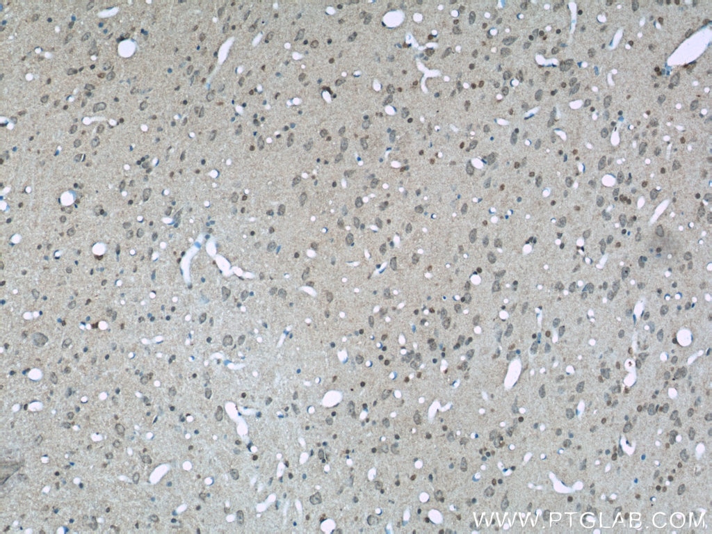 Immunohistochemistry (IHC) staining of rat brain tissue using NCOR1 Polyclonal antibody (20018-1-AP)