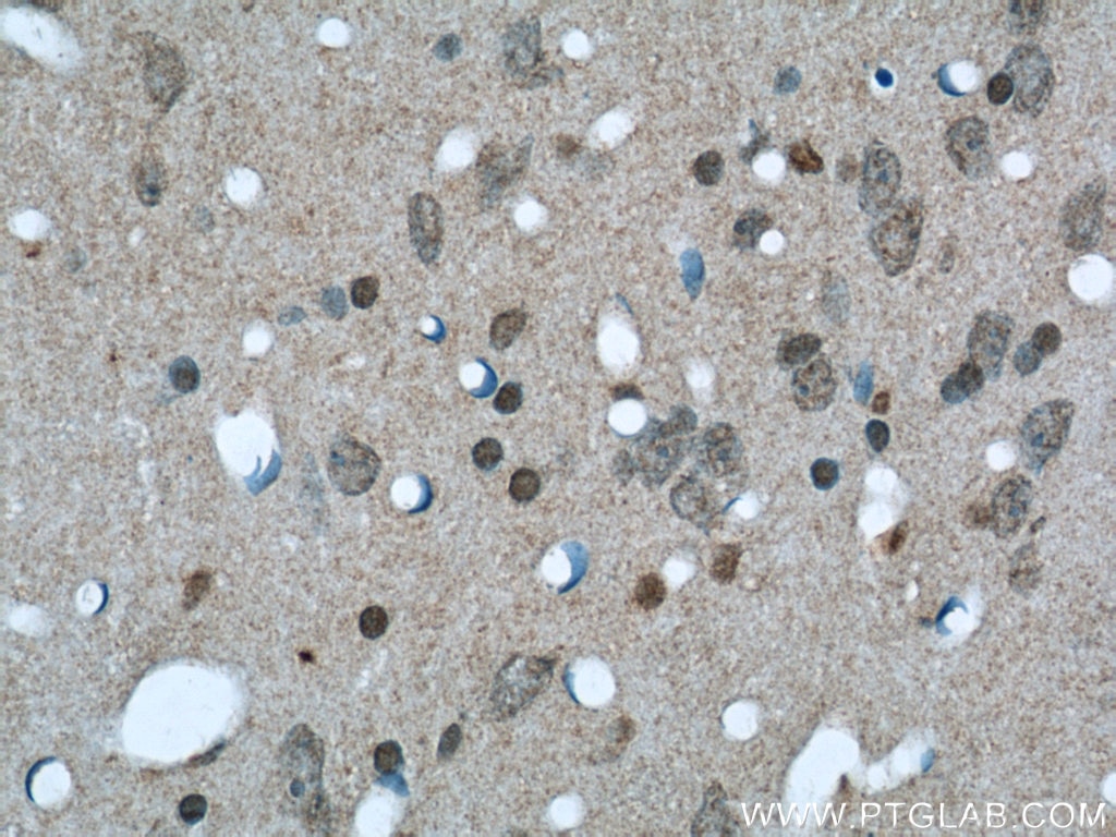Immunohistochemistry (IHC) staining of rat brain tissue using NCOR1 Polyclonal antibody (20018-1-AP)