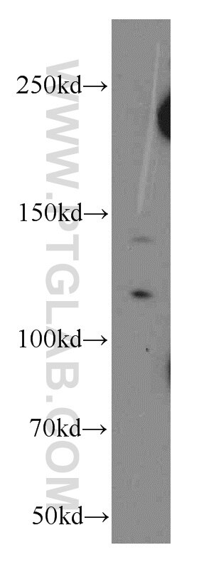 Western Blot (WB) analysis of K-562 cells using NCOR1 Polyclonal antibody (20018-1-AP)