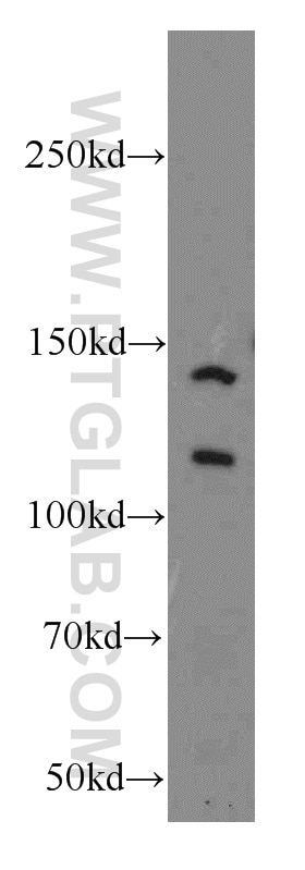 Western Blot (WB) analysis of HepG2 cells using NCOR1 Polyclonal antibody (20018-1-AP)