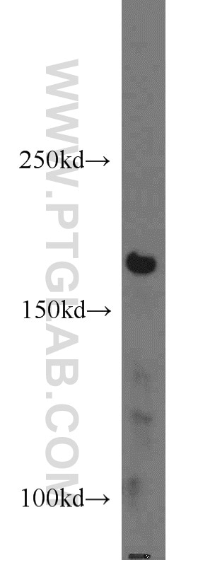 Western Blot (WB) analysis of HeLa cells using NCOR2 Polyclonal antibody (20017-1-AP)