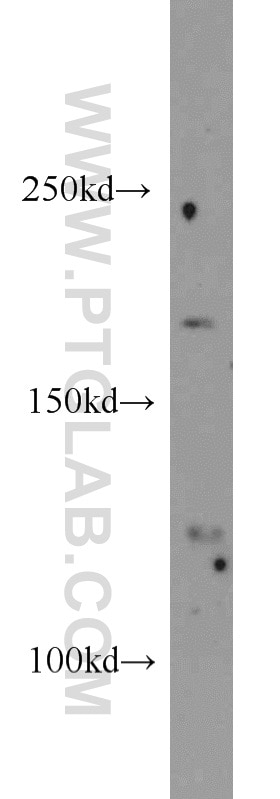 Western Blot (WB) analysis of Jurkat cells using NCOR2 Polyclonal antibody (20017-1-AP)