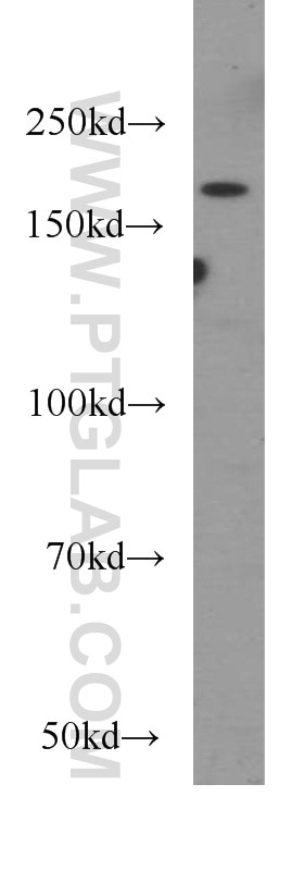 NCOR2 Polyclonal antibody