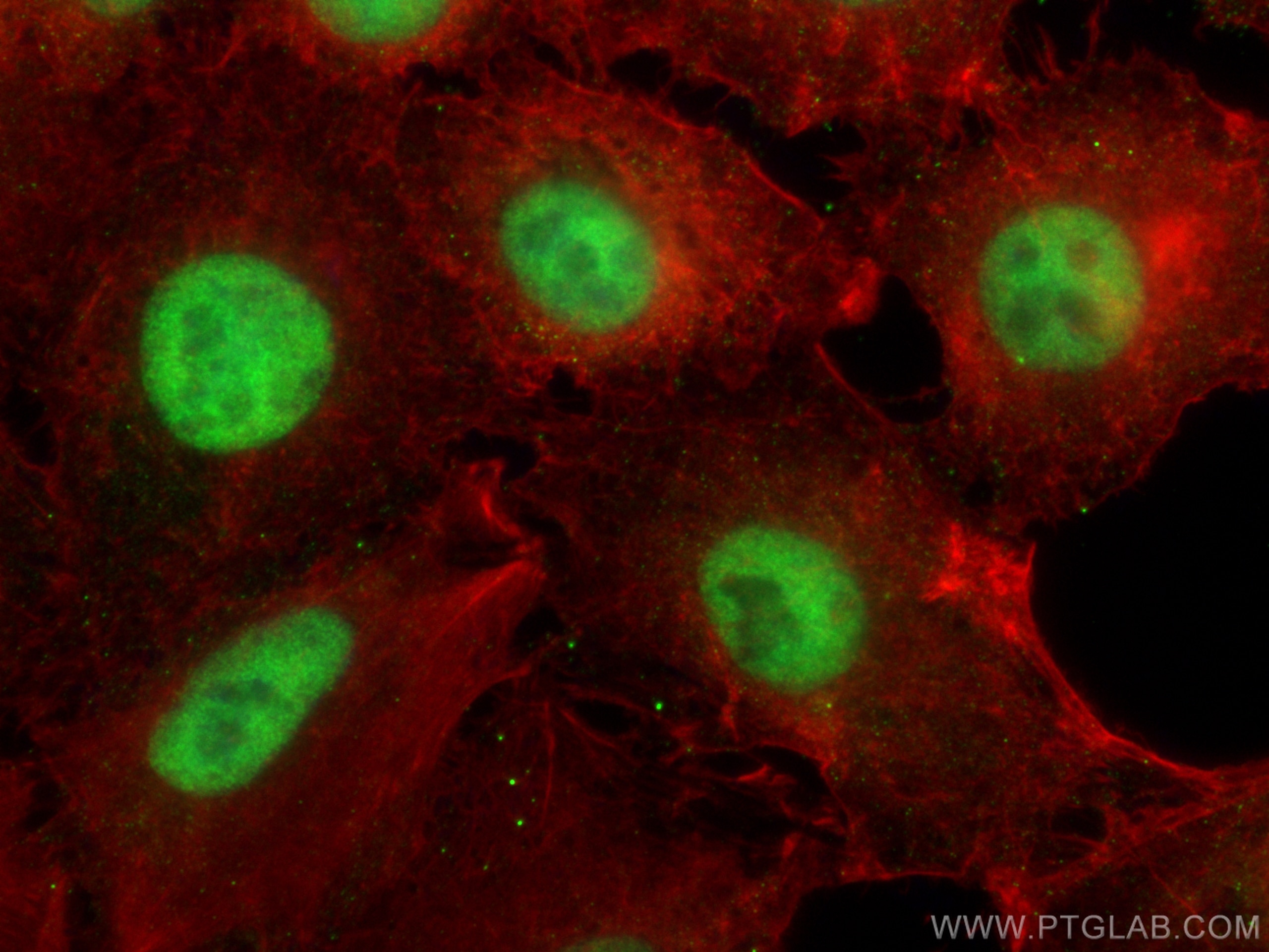 Immunofluorescence (IF) / fluorescent staining of A549 cells using NCOR2 Polyclonal antibody (29952-1-AP)