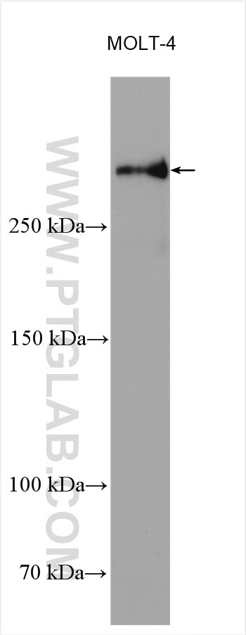 Western Blot (WB) analysis of various lysates using NCOR2 Polyclonal antibody (29952-1-AP)