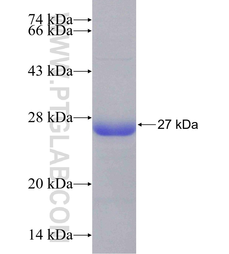 NCOR2 fusion protein Ag30741 SDS-PAGE NCOR2 fusion protein Ag30741 SDS-PAGE