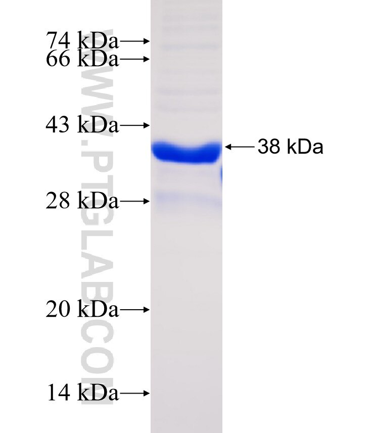 NCR1 Fusion Protein Ag31129 Proteintech