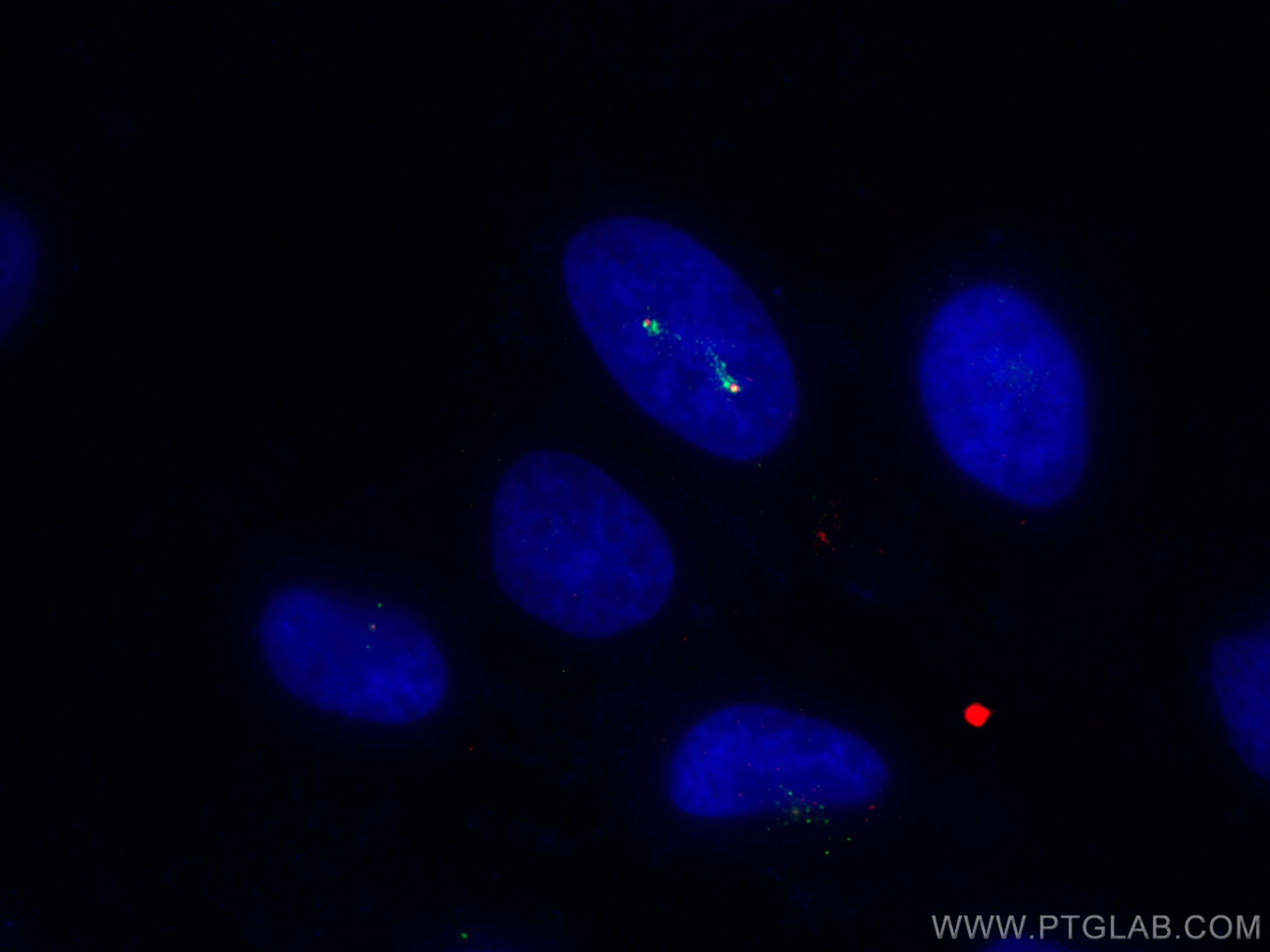 Immunofluorescence (IF) / fluorescent staining of HeLa cells using Kiz Polyclonal antibody (21177-1-AP)
