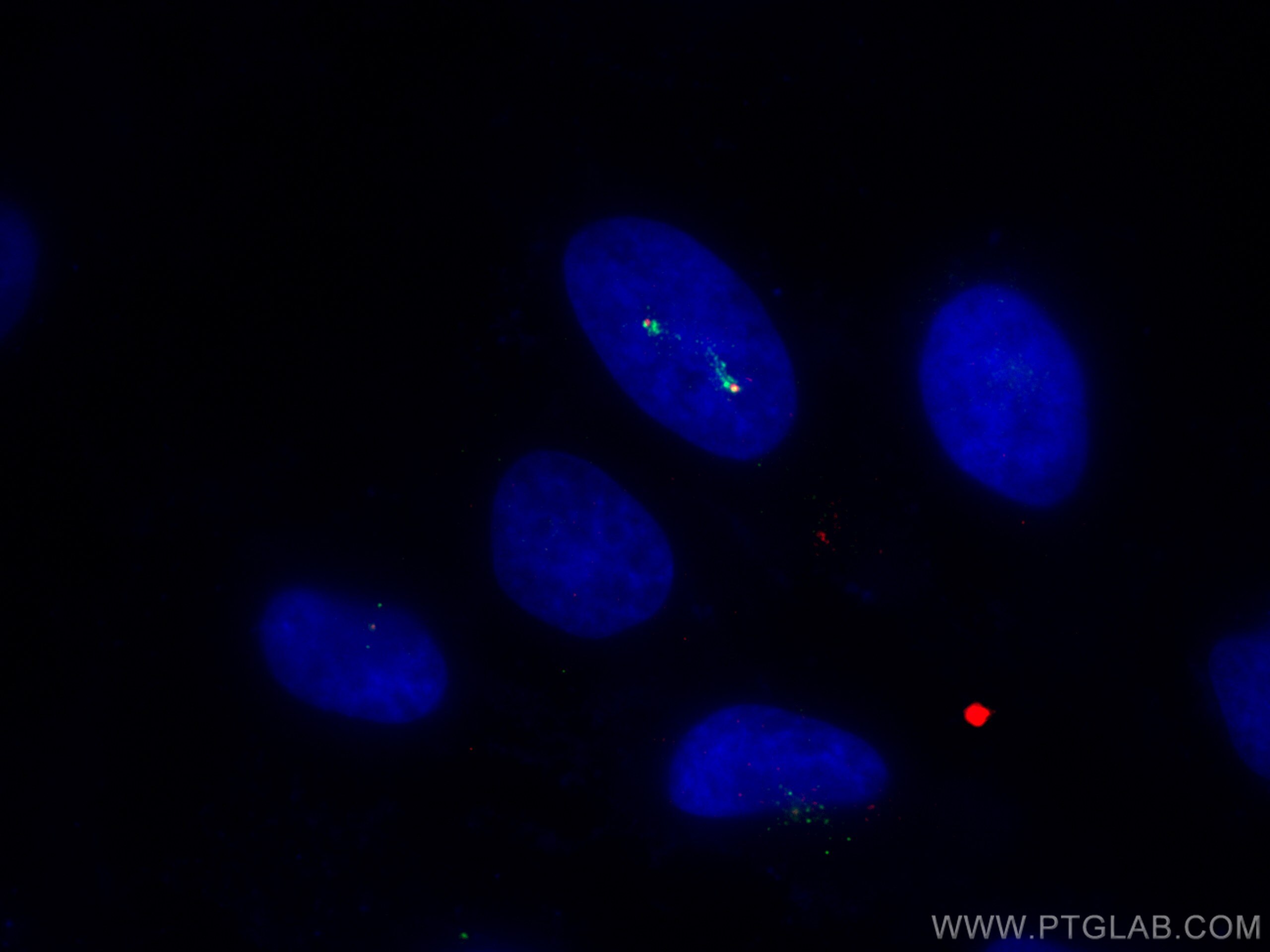 IF Staining of HeLa using 21177-1-AP