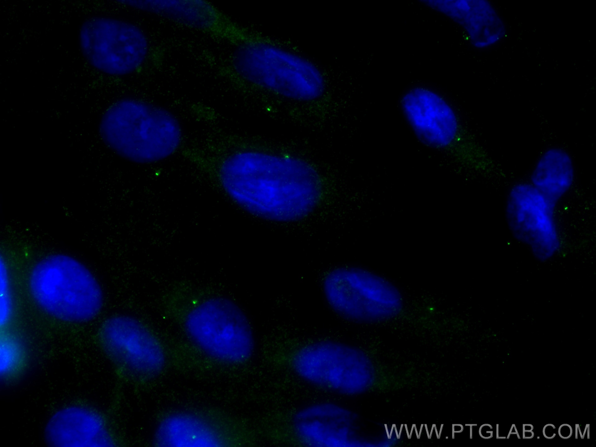 Immunofluorescence (IF) / fluorescent staining of hTERT-RPE1 cells using Kiz Polyclonal antibody (21177-1-AP)