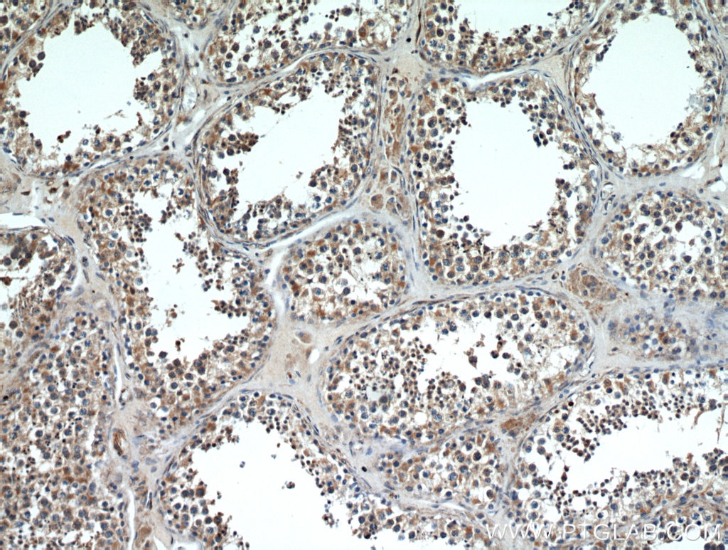 Immunohistochemistry (IHC) staining of human testis tissue using Kiz Polyclonal antibody (21177-1-AP)
