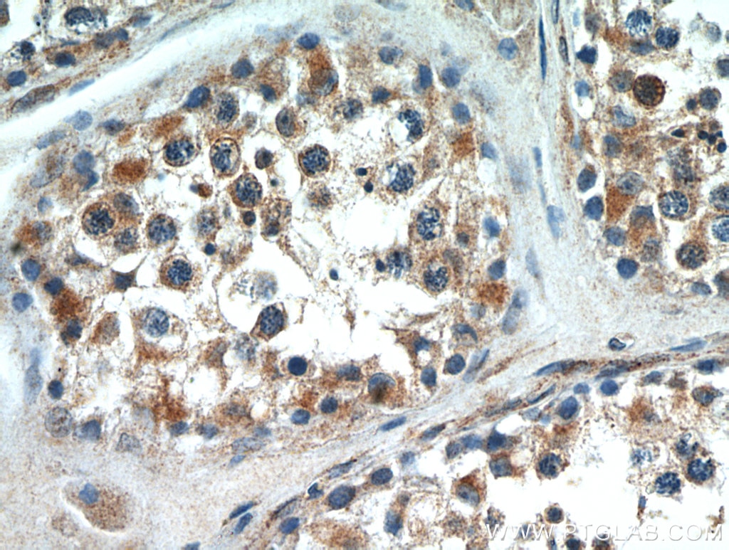 Immunohistochemistry (IHC) staining of human testis tissue using Kiz Polyclonal antibody (21177-1-AP)