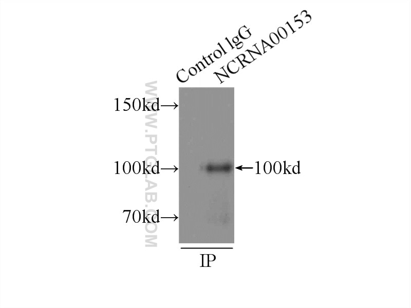 IP experiment of HeLa using 21177-1-AP