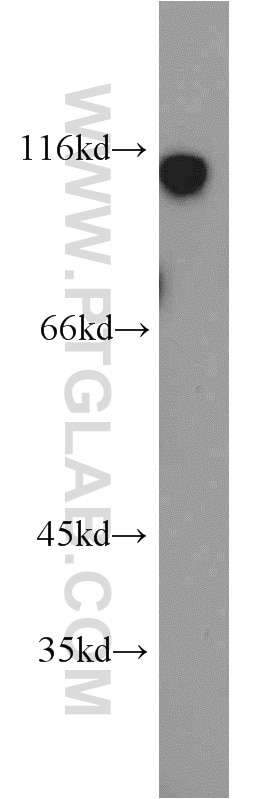 Western Blot (WB) analysis of human brain tissue using Kiz Polyclonal antibody (21177-1-AP)