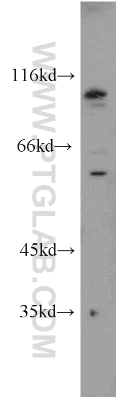 Western Blot (WB) analysis of HeLa cells using Kiz Polyclonal antibody (21177-1-AP)